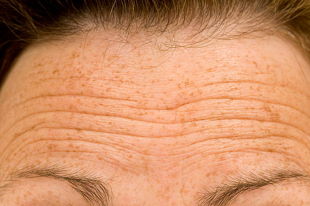 Skin Care To Prevent Wrinkles